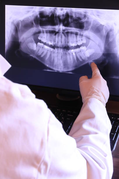 Best Emergency Dentist for Lost Fillings or Crowns in Sea Bright, NJ